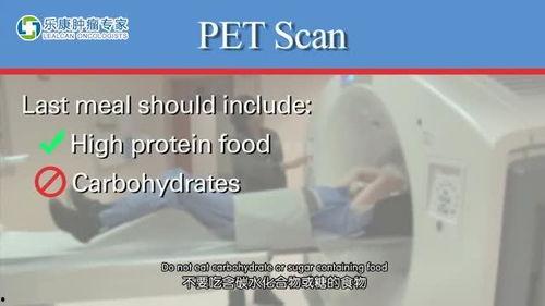 中国国产ct宣传视频大全,探索中国医疗影像技术新篇章